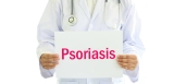 Psoriasis og behandling